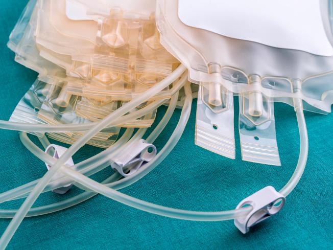 A closeup photo of IV bags and medical tubing.